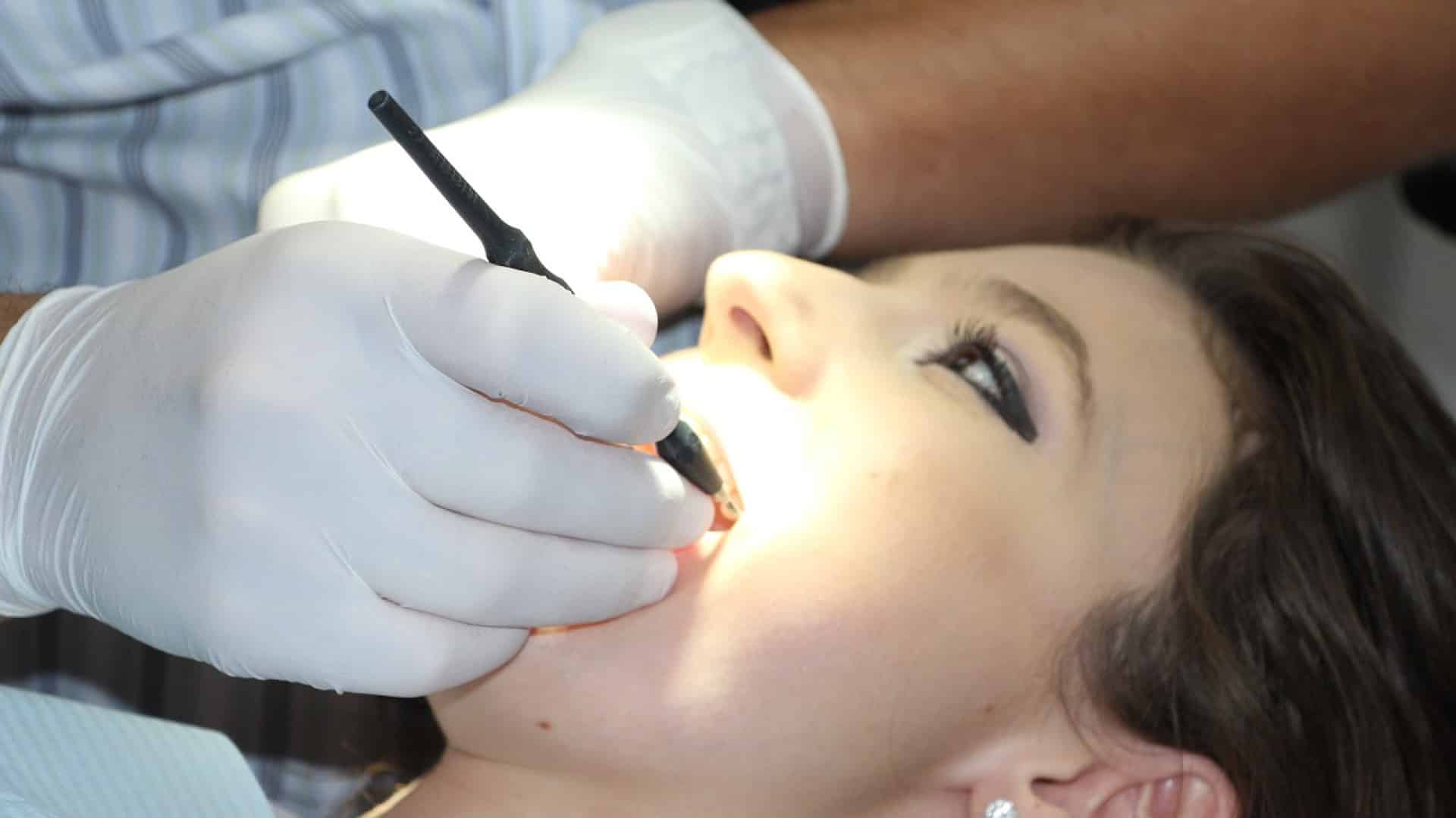 Bridge dentaire : quels sont ses avantages ?
